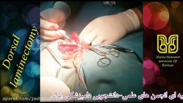 Dorsal Laminectomy