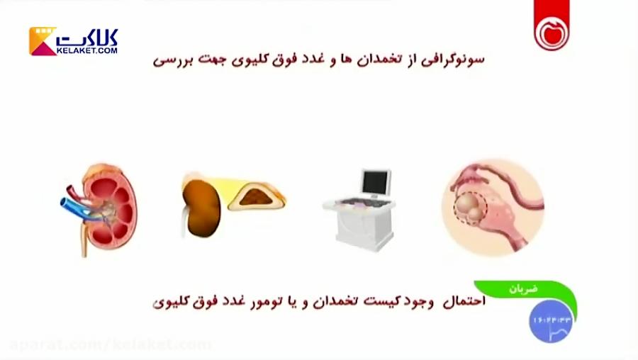 علائم،علل درمان پرمویی زائد در بانوان