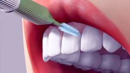 how to use an interdental brush