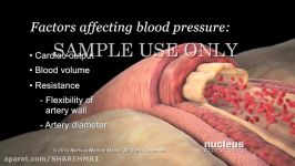 High Blood Pressure Hypertension