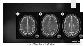 آناتومی مقطعی مغز در تصاویر MRI