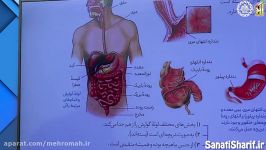 آموزش زیست دهم  فصل دوم  گوارش جذب مواد 4