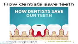 دندان پزشکان چطور دندان ما مراقبت می کنند