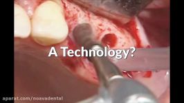 an introduction to oral surgery clip