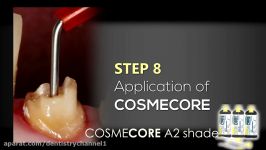 بیلدآپ سمان کردن پست کور Cosmecore