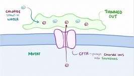 سیستیک فیبروزیس