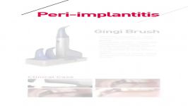 NeoBiotech Peri Implantitis Solutions