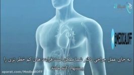 انیمیشن باز كردن عروق كرونرقلب توسط پزشكانآنژیوپلاستی