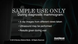 Breast Cancer  Mammogram  Nucleus Health