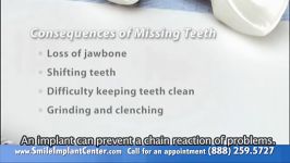 A Single Implant  Why Replace Missing Teeth