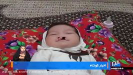 نوزادی در اصلاندوز بدون فک بینی متولد شد