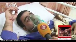 گزارشی مصدومان بستری شده پلاسکو در بیمارستان