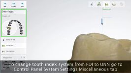 3shape Dental Designer User Interface 2015