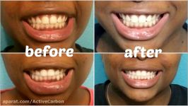 WHITEN TEETH IN 2 WEEKS USING ACTIVATED CHARCOAL