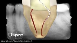 انیمیشن 3 بعدی درمان ریشه شرکت Dentsply