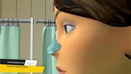 Nose surgery