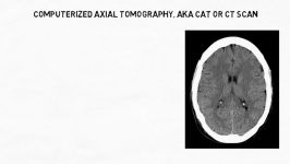 2 Minute Neuroscience Neuroimaging