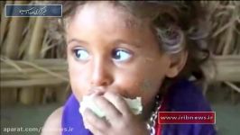 هشدار سازمان ملل به گرسنگی گسترده در یمن