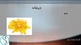 روش جدید درمان خارپاشنه