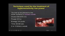 کاربرد لیزر در درمان ریشه دندان  laser in Endodontics