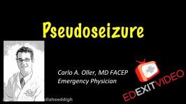 Pseudoseizure