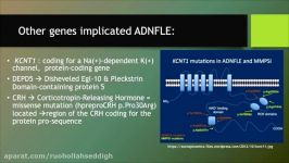 Autosomal Dominant Frontal Lobe Epilepsy ADNFLE