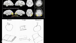 02 Visual form agnosia