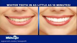 دستگاه سفید کننده دندان، روشی منحصر به فرد، Mapeli.com