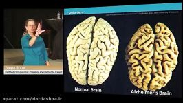 راهکار ها ترفندها  سازشگری بیمار مبتلا به دمانس