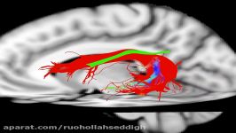 Animated 3D model of arcuate fasciculus segments