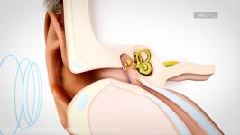 Conductive Hearing Loss Explained  MED EL