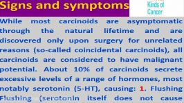 Carcinoid TumorSigns And SymptomsTreatment