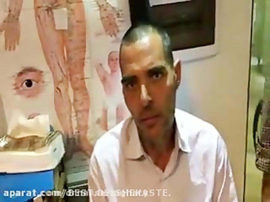 طب سوزنی بهبود بیماری اعصاب دکتر ناصر سیگاری