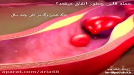 حمله قلبی چطور بوجود میاد؟ آریا