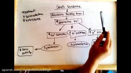 Conns syndrome hyperaldosteronism  cause and treatment