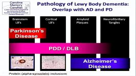 Understanding Lewy Body Dementia