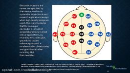 brain waves and eeg electrode placement and qeeg 2