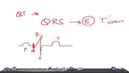 Medical Video Lecture QT interval and Corrected QT interval QTc