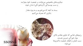 مواردی باعث پوسیدگی دندان می شوند