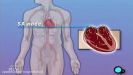 Permanent Pacemaker Implant Surgery