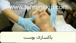 قدم به قدم لایه بردارهای شیمیایی