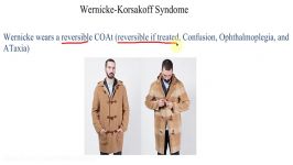 Wernicke Korsakoff Syndrome Mnemonic