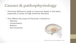 Wernicke Korsakoff Syndrome