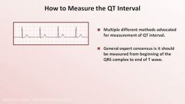 Advanced EKGs  The QT Interval and Long QT Syndrome