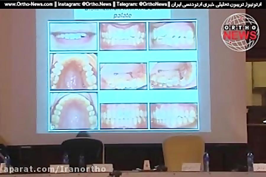 نوآوری در ارتودنسی  دکتر قریشی  نهمین نشست قسمت 2