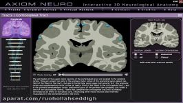 Neuroanatomy  The Corticospinal Tract in 3D