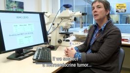 Neuroendocrine carcinomas outside the lungs NEC Cancer