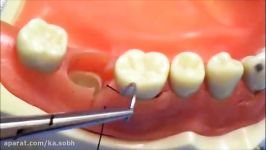 Suturing Essential How to tie a Surgical Knot