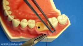 Surgical Technique  Figure of Eight Close Vertical Dental