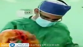 خارج کردن روده بزرگ ۵ کیلویی شکم خانم ۵۲ ساله